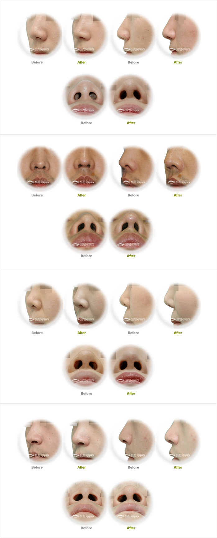 all different nose shapes